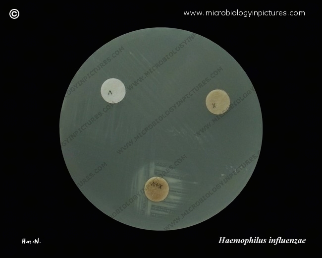 Haemophilus influenzae X and V factors requirement X factor, V factor, X+V factors